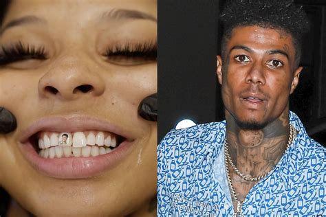 blueface girlfriend with missing tooth|Chrisean Rock Gets a New Tooth With Blueface’s。